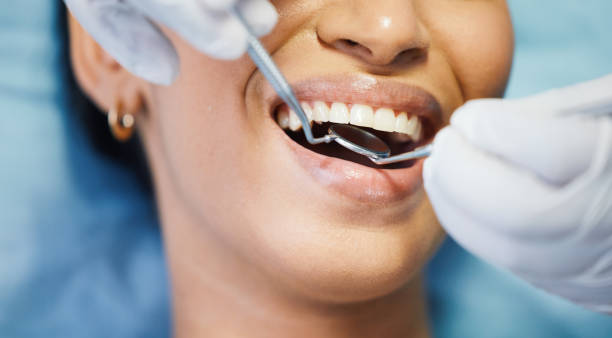 Best Dentist for Tooth Abscess  in Hector, MN